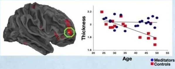 méditation cerveau